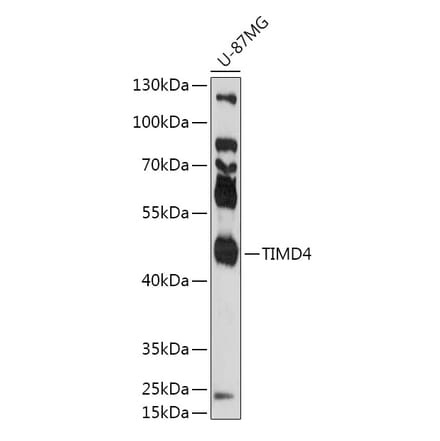 Western Blot - Anti-TIM 4 Antibody (A305821) - Antibodies.com