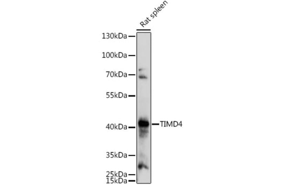 Western Blot - Anti-TIM 4 Antibody (A305821) - Antibodies.com