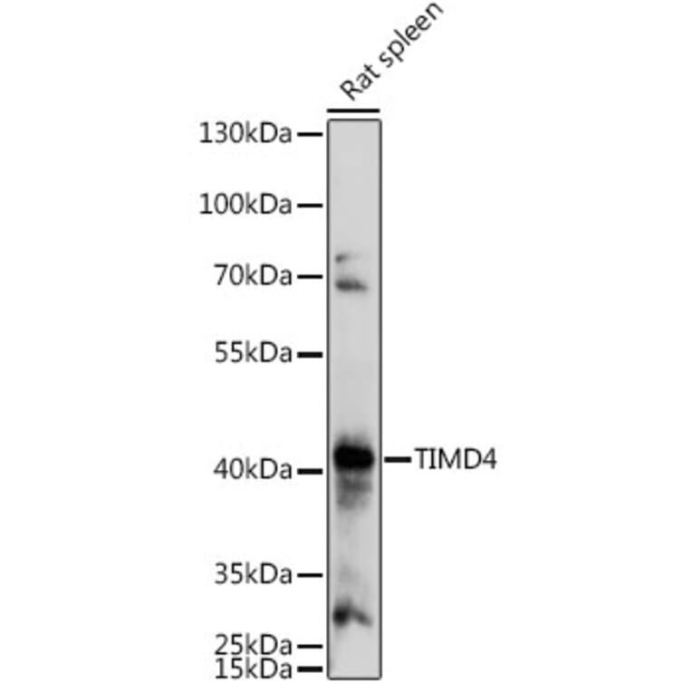 Western Blot - Anti-TIM 4 Antibody (A305821) - Antibodies.com