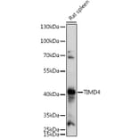 Western Blot - Anti-TIM 4 Antibody (A305821) - Antibodies.com