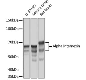 Western Blot - Anti-alpha Internexin Antibody [ARC2054] (A305822) - Antibodies.com