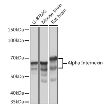 Western Blot - Anti-alpha Internexin Antibody [ARC2054] (A305822) - Antibodies.com