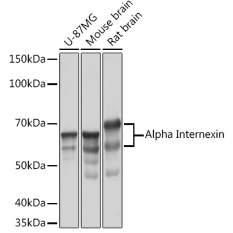 Western Blot - Anti-alpha Internexin Antibody [ARC2054] (A305822) - Antibodies.com