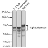 Western Blot - Anti-alpha Internexin Antibody [ARC2054] (A305822) - Antibodies.com