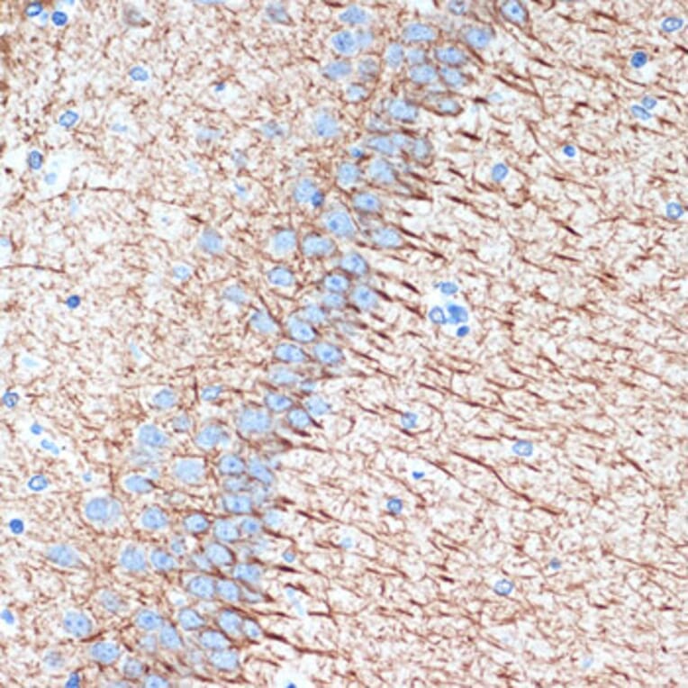 Immunohistochemistry - Anti-alpha Internexin Antibody [ARC2054] (A305822) - Antibodies.com