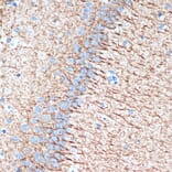 Immunohistochemistry - Anti-alpha Internexin Antibody [ARC2054] (A305822) - Antibodies.com