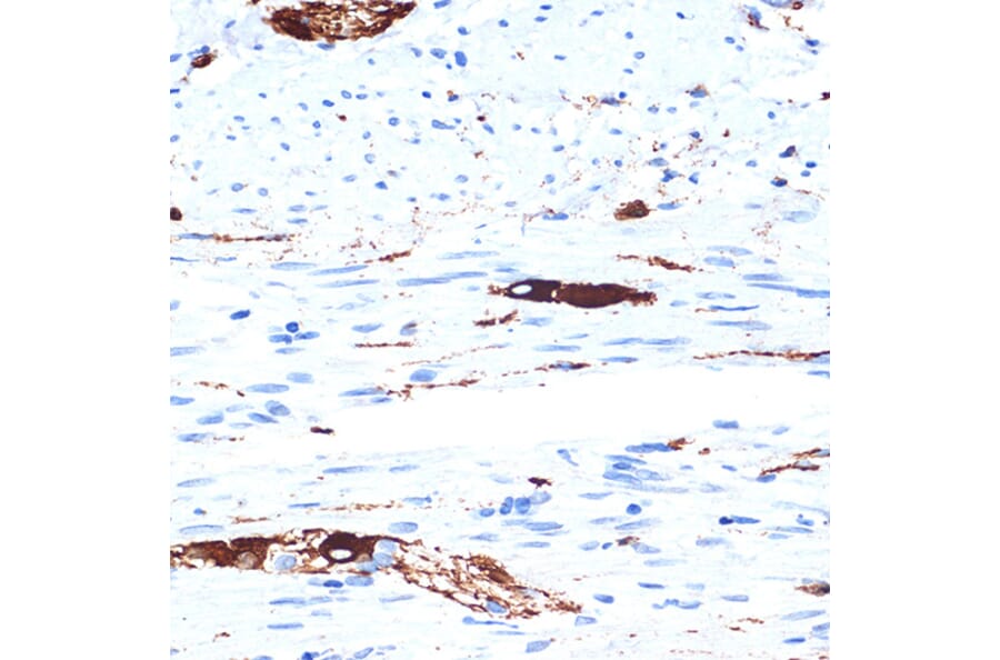 Immunohistochemistry - Anti-alpha Internexin Antibody [ARC2054] (A305822) - Antibodies.com