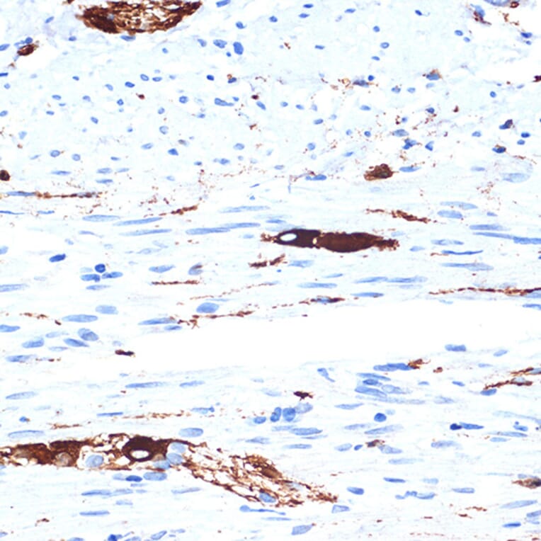 Immunohistochemistry - Anti-alpha Internexin Antibody [ARC2054] (A305822) - Antibodies.com