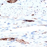 Immunohistochemistry - Anti-alpha Internexin Antibody [ARC2054] (A305822) - Antibodies.com