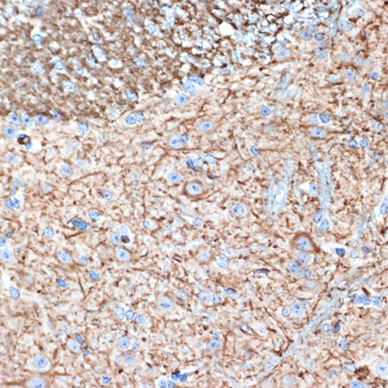 Immunohistochemistry - Anti-alpha Internexin Antibody [ARC2054] (A305822) - Antibodies.com