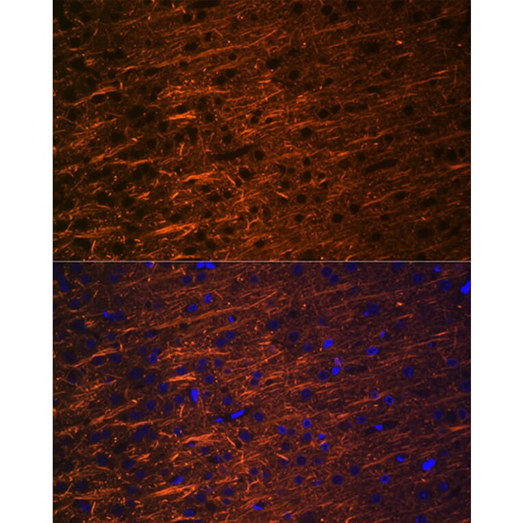 Immunofluorescence - Anti-alpha Internexin Antibody [ARC2054] (A305822) - Antibodies.com