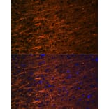 Immunofluorescence - Anti-alpha Internexin Antibody [ARC2054] (A305822) - Antibodies.com