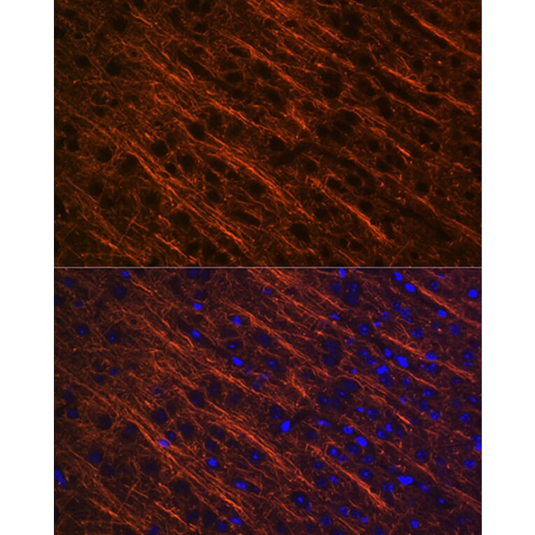 Immunofluorescence - Anti-alpha Internexin Antibody [ARC2054] (A305822) - Antibodies.com