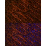 Immunofluorescence - Anti-alpha Internexin Antibody [ARC2054] (A305822) - Antibodies.com