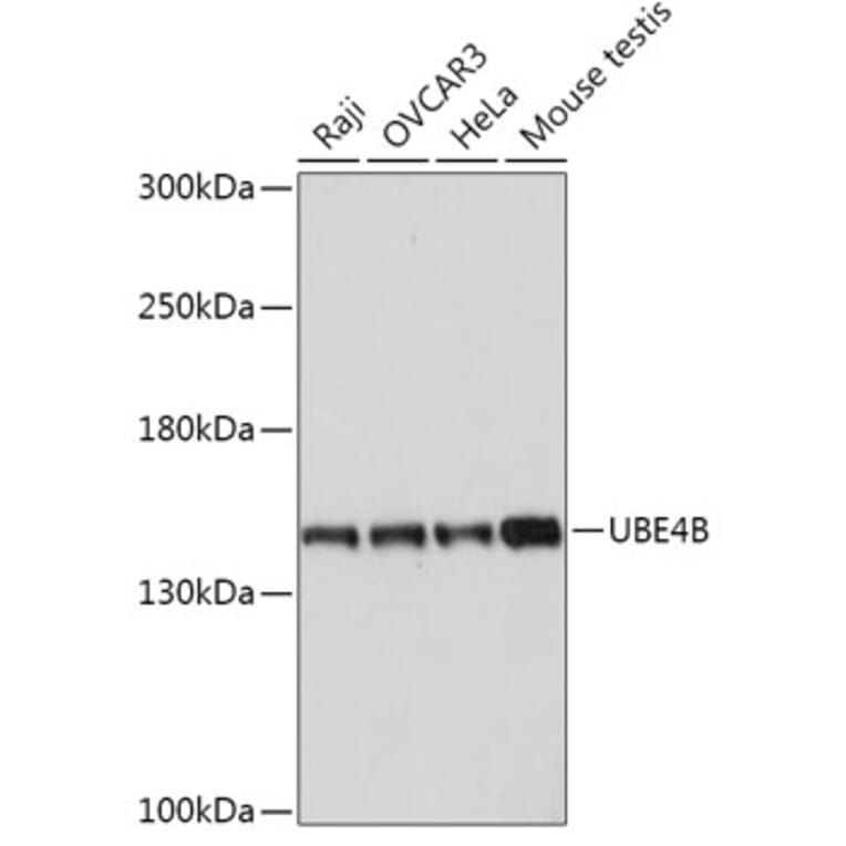Western Blot - Anti-UBE4B Antibody (A305823) - Antibodies.com