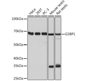 Western Blot - Anti-G3BP Antibody [ARC0875] (A305824) - Antibodies.com