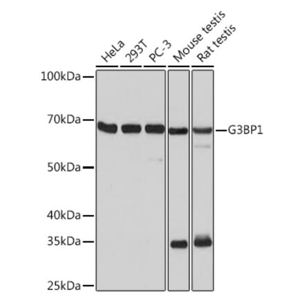 Western Blot - Anti-G3BP Antibody [ARC0875] (A305824) - Antibodies.com