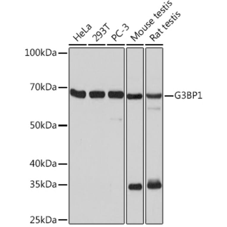 Western Blot - Anti-G3BP Antibody [ARC0875] (A305824) - Antibodies.com