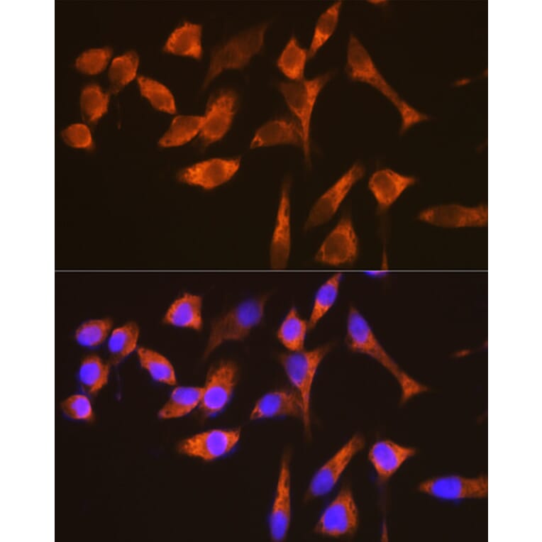 Immunofluorescence - Anti-G3BP Antibody [ARC0875] (A305824) - Antibodies.com