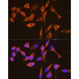 Immunofluorescence - Anti-G3BP Antibody [ARC0875] (A305824) - Antibodies.com