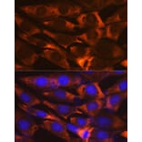 Immunofluorescence - Anti-G3BP Antibody [ARC0875] (A305824) - Antibodies.com