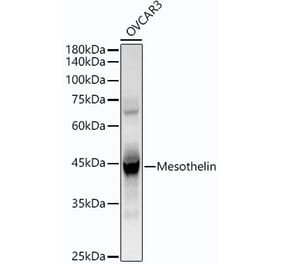 Western Blot - Anti-Mesothelin Antibody [ARC54390] (A305825) - Antibodies.com