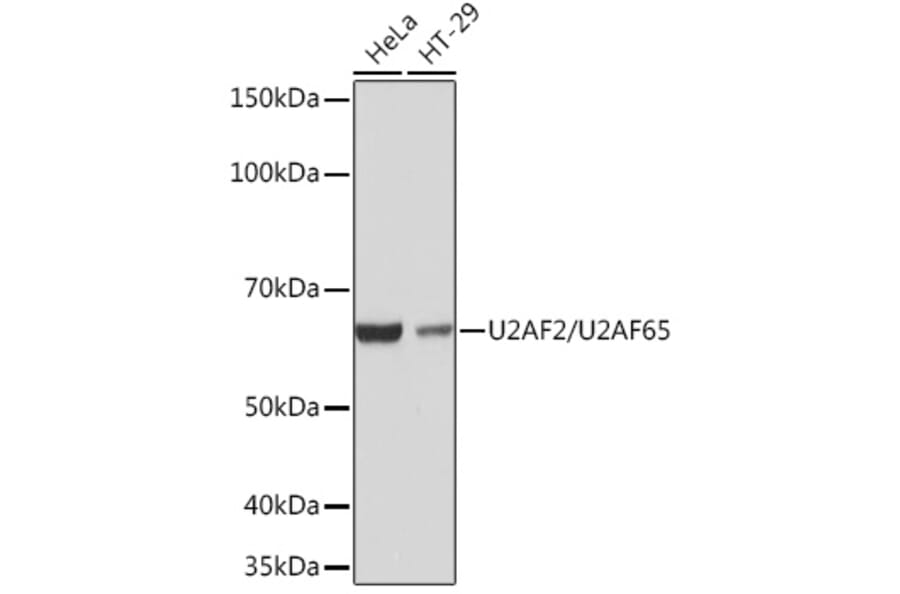 Western Blot - Anti-U2AF65 Antibody [ARC1029] (A305827) - Antibodies.com