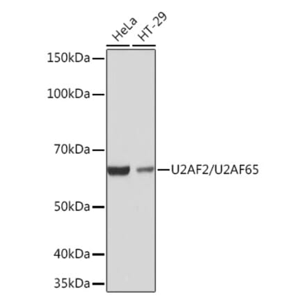 Western Blot - Anti-U2AF65 Antibody [ARC1029] (A305827) - Antibodies.com