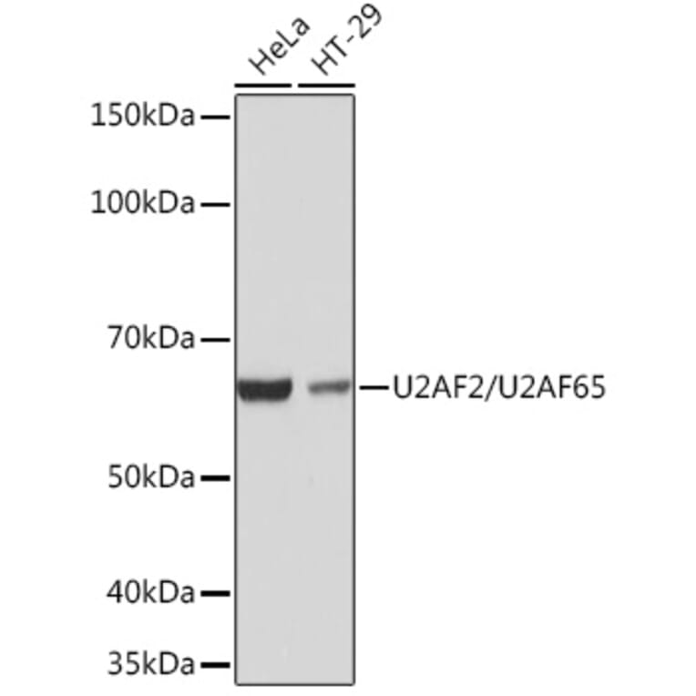 Western Blot - Anti-U2AF65 Antibody [ARC1029] (A305827) - Antibodies.com