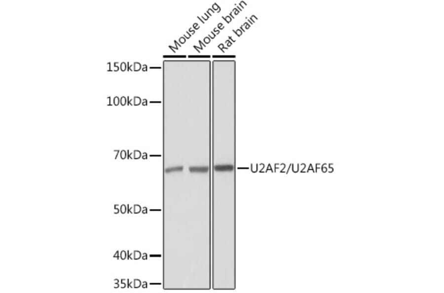 Western Blot - Anti-U2AF65 Antibody [ARC1029] (A305827) - Antibodies.com
