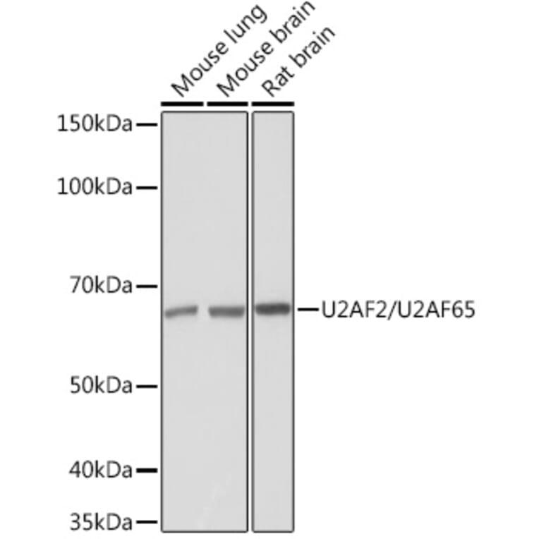 Western Blot - Anti-U2AF65 Antibody [ARC1029] (A305827) - Antibodies.com