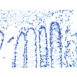 Immunohistochemistry - Anti-U2AF65 Antibody [ARC1029] (A305827) - Antibodies.com