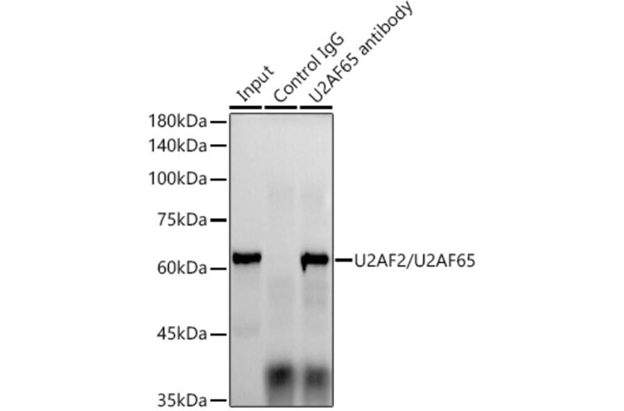 Western Blot - Anti-U2AF65 Antibody [ARC1029] (A305827) - Antibodies.com
