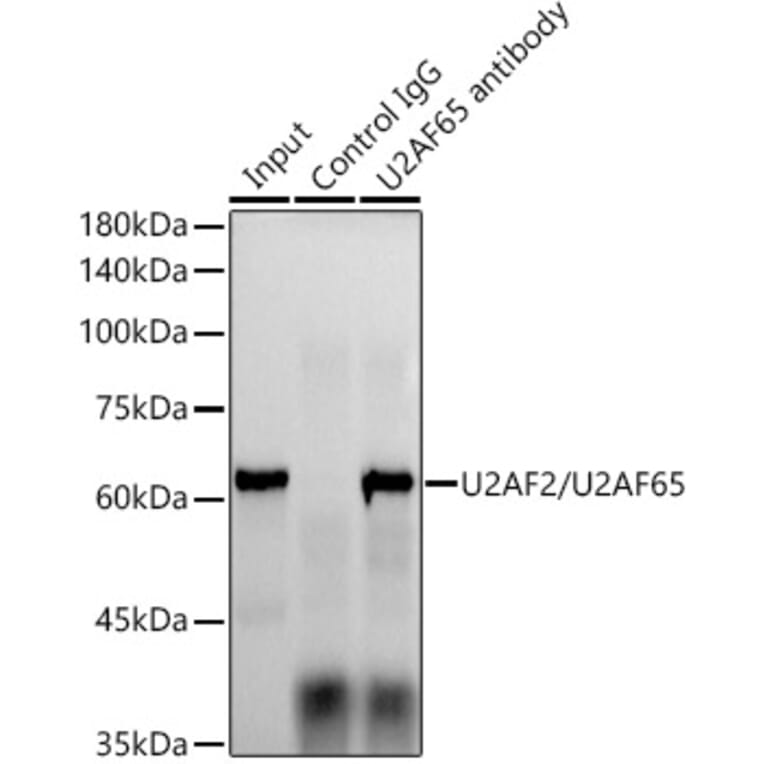 Western Blot - Anti-U2AF65 Antibody [ARC1029] (A305827) - Antibodies.com