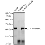 Western Blot - Anti-U2AF65 Antibody [ARC1029] (A305827) - Antibodies.com