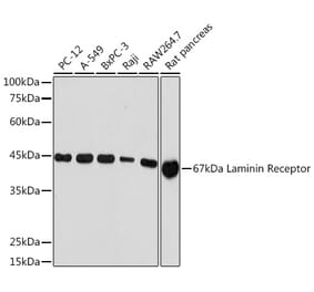 Western Blot - Anti-67kDa Laminin Receptor Antibody [ARC2109] (A305828) - Antibodies.com