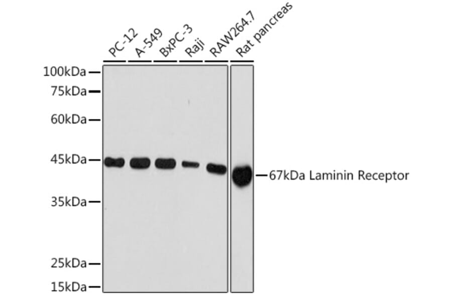 Western Blot - Anti-67kDa Laminin Receptor Antibody [ARC2109] (A305828) - Antibodies.com