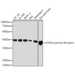 Western Blot - Anti-67kDa Laminin Receptor Antibody [ARC2109] (A305828) - Antibodies.com