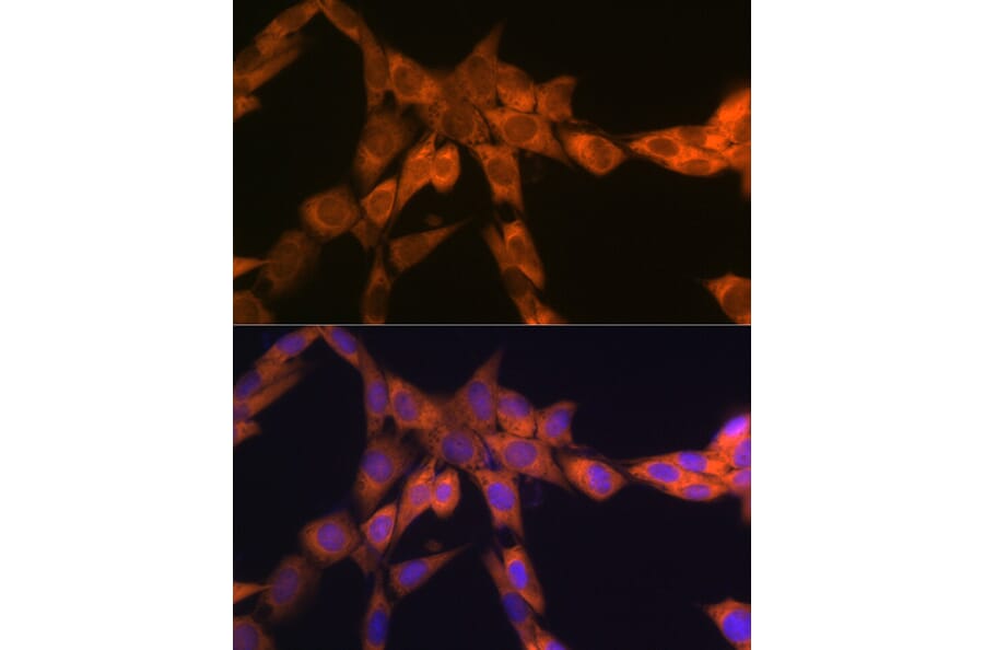 Immunofluorescence - Anti-67kDa Laminin Receptor Antibody [ARC2109] (A305828) - Antibodies.com