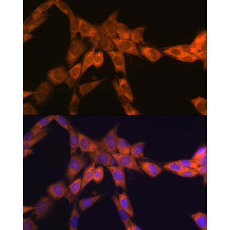 Immunofluorescence - Anti-67kDa Laminin Receptor Antibody [ARC2109] (A305828) - Antibodies.com