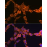 Immunofluorescence - Anti-67kDa Laminin Receptor Antibody [ARC2109] (A305828) - Antibodies.com