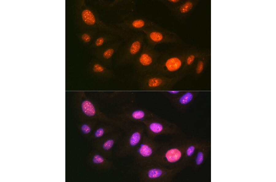 Immunofluorescence - Anti-E1 Ubiquitin Activating Enzyme 1/UBA1 Antibody [ARC1493] (A305829) - Antibodies.com