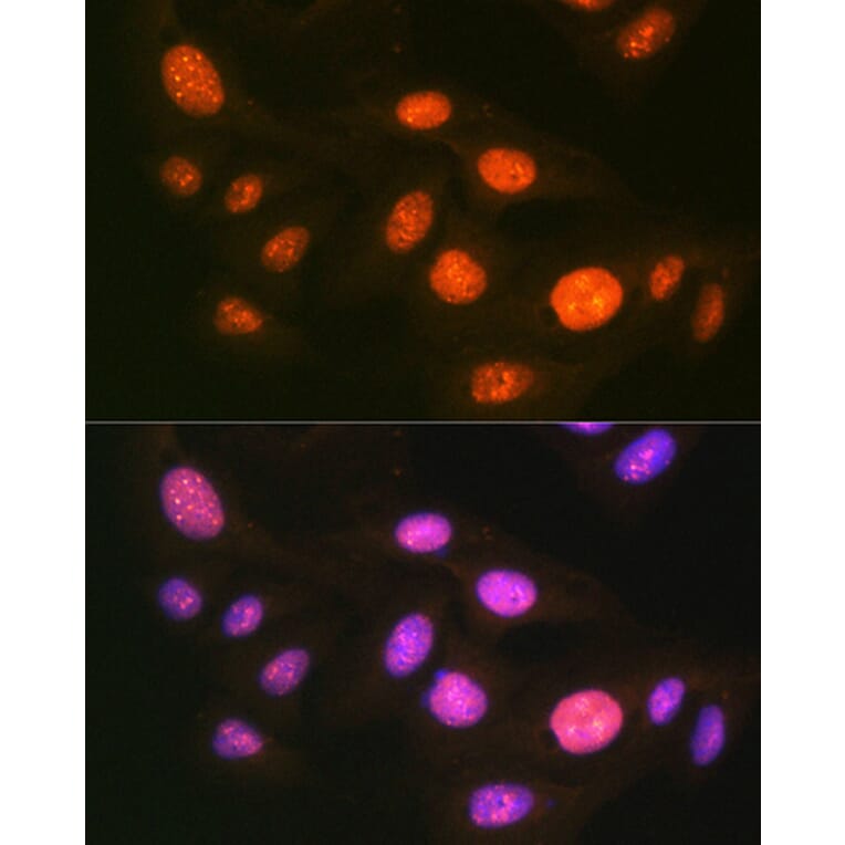 Immunofluorescence - Anti-E1 Ubiquitin Activating Enzyme 1/UBA1 Antibody [ARC1493] (A305829) - Antibodies.com