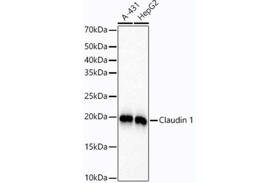 Western Blot - Anti-Claudin 1 Antibody [ARC54475] (A305830) - Antibodies.com