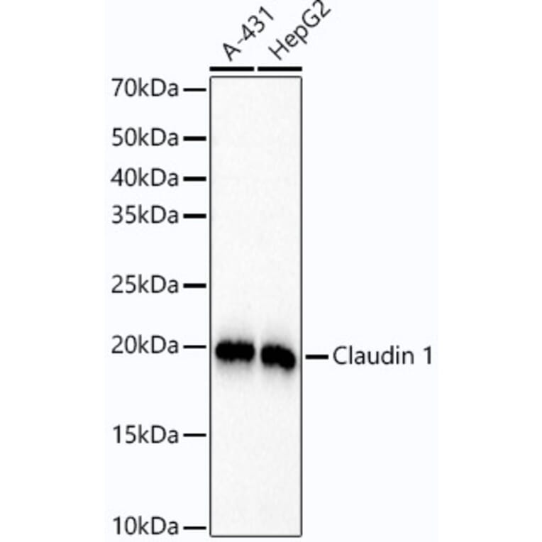 Western Blot - Anti-Claudin 1 Antibody [ARC54475] (A305830) - Antibodies.com