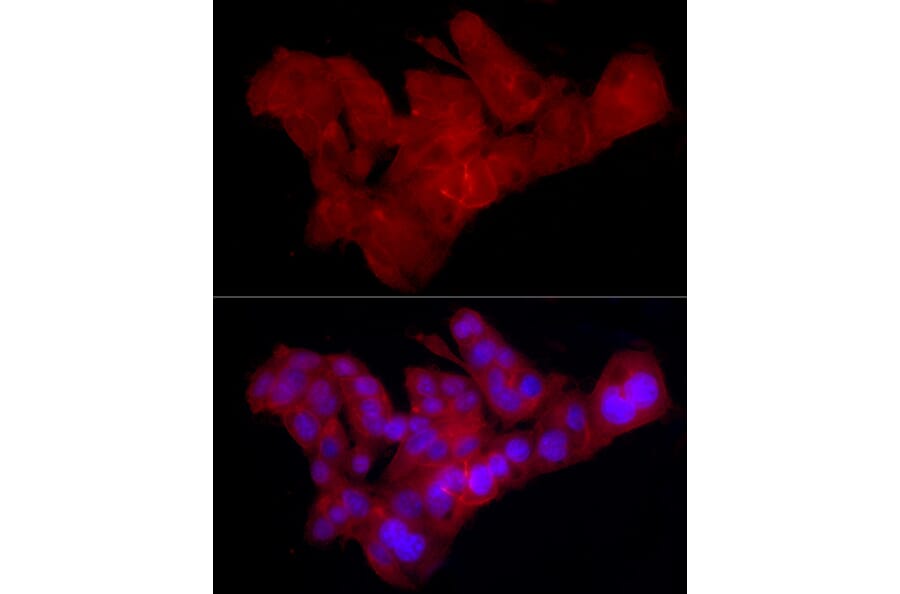 Immunofluorescence - Anti-Claudin 1 Antibody [ARC54475] (A305830) - Antibodies.com