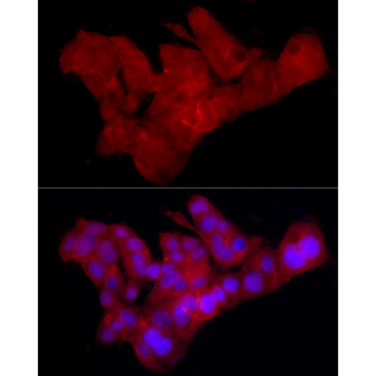 Immunofluorescence - Anti-Claudin 1 Antibody [ARC54475] (A305830) - Antibodies.com
