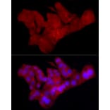 Immunofluorescence - Anti-Claudin 1 Antibody [ARC54475] (A305830) - Antibodies.com