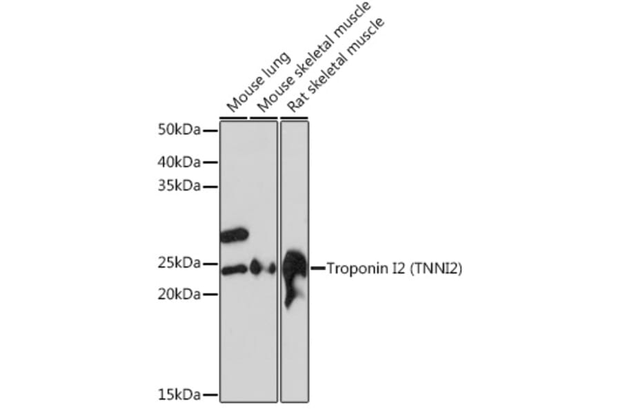 Western Blot - Anti-Troponin I fast skeletal muscle Antibody [ARC1114] (A305831) - Antibodies.com