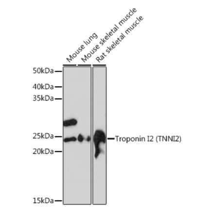 Western Blot - Anti-Troponin I fast skeletal muscle Antibody [ARC1114] (A305831) - Antibodies.com